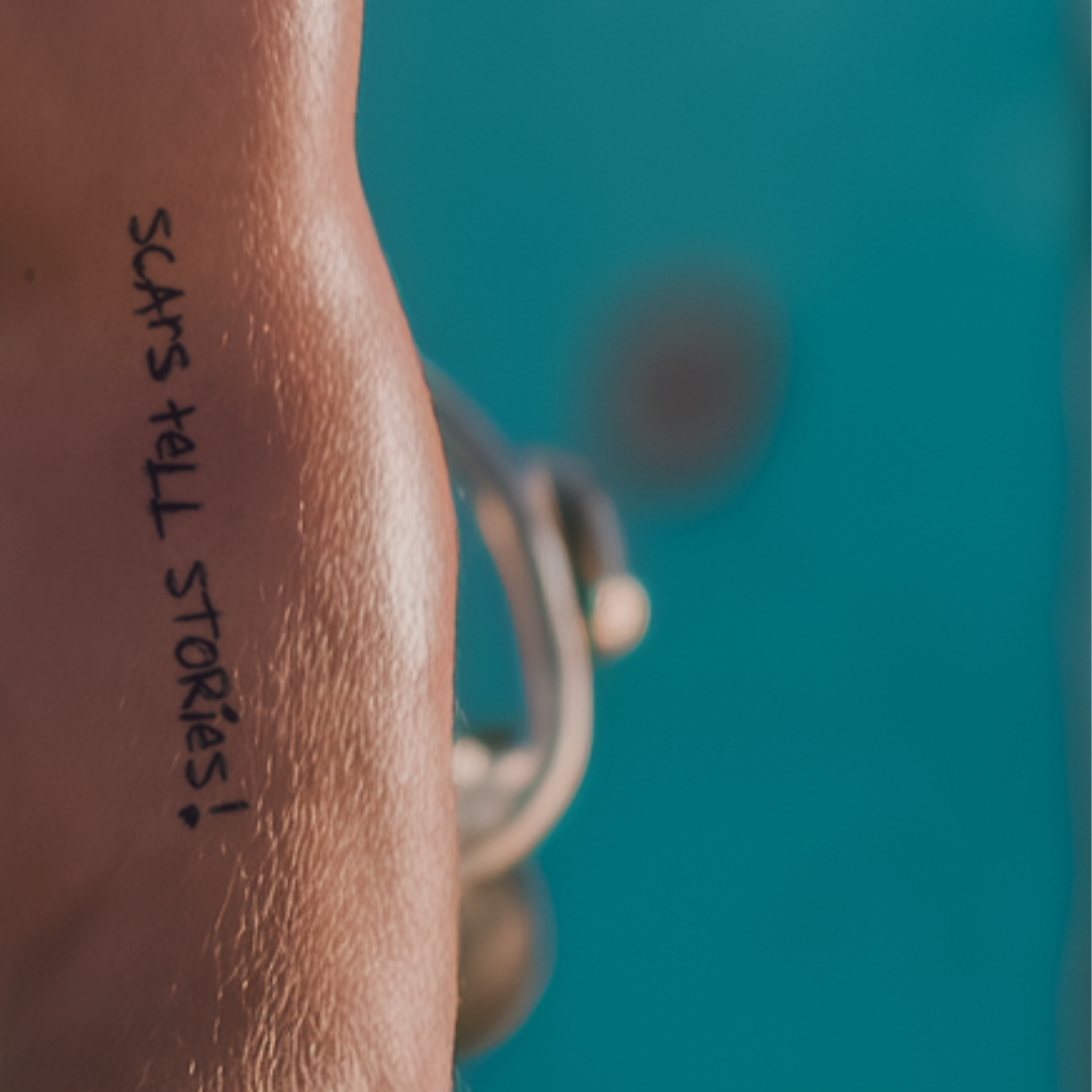 Scars tell stories! Tattoo